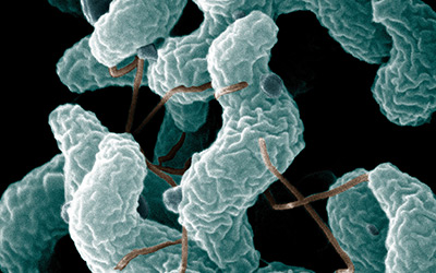 Campylobacter bacteria under a microscope